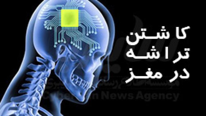 کاشت