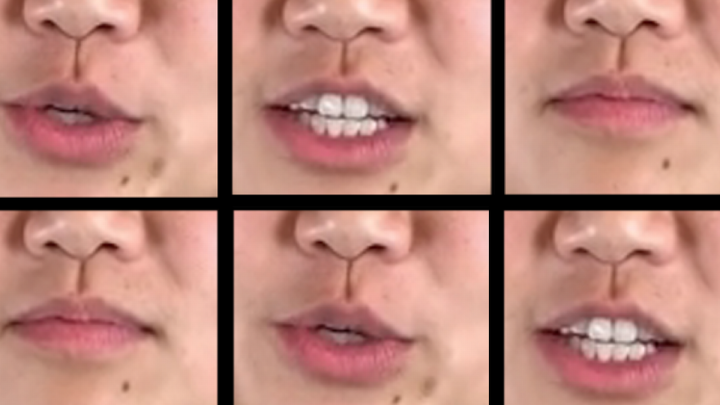 تشخیص